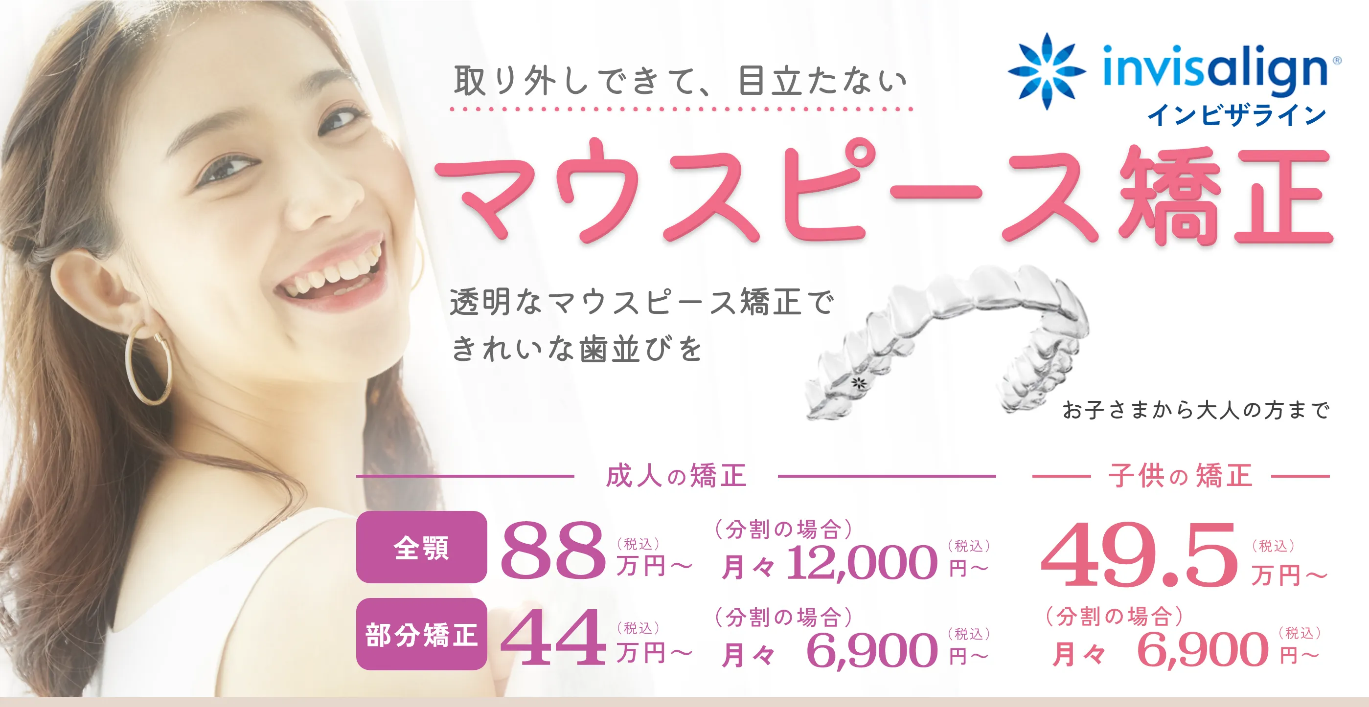 マウスピース矯正